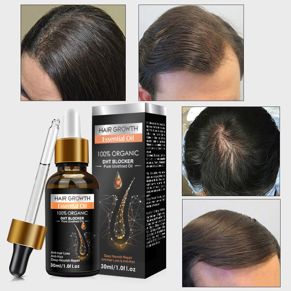 Ginger Hair Essential Oil Improves Circulation Scalp Massage Essential Oil