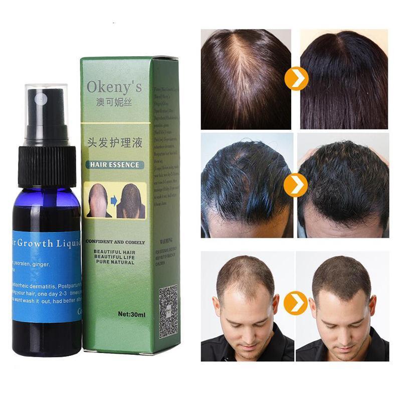 Sunburst Anti Hair Loss Alopecia Traditional Chinese Herb Serum