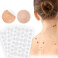Waterproof Water Gel Acne Patch To Reduce Acne Marks
