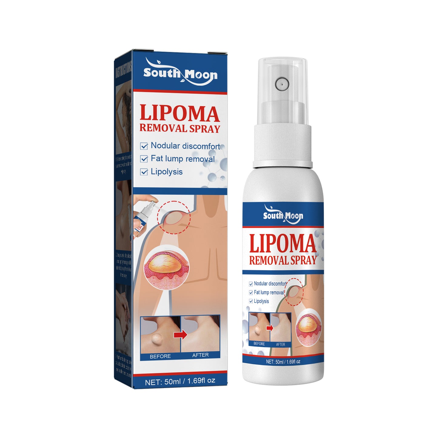 Relief Of Body Fat Lump, Subcutaneous Fat Nodule, Dredging Spray