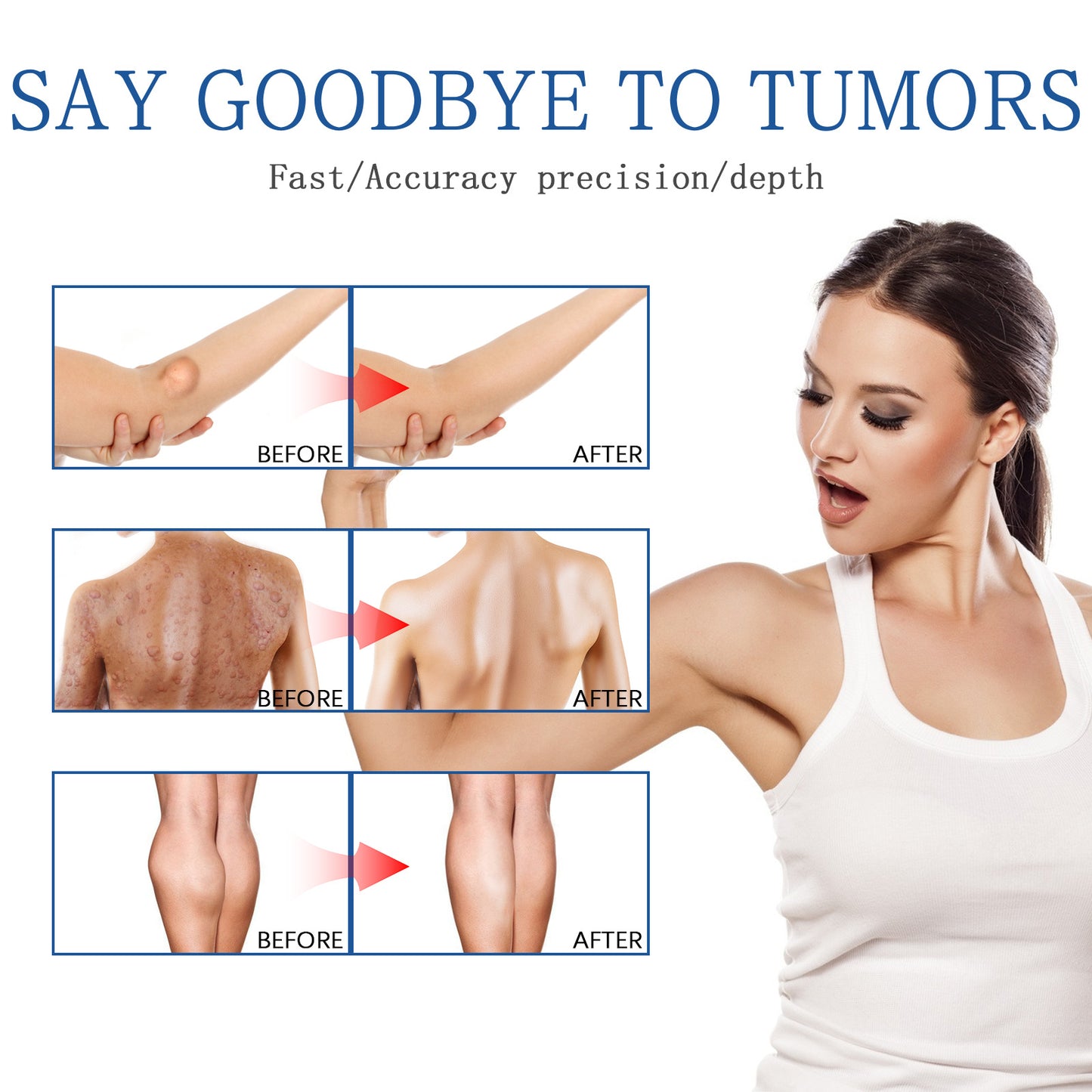 Relief Of Body Fat Lump, Subcutaneous Fat Nodule, Dredging Spray