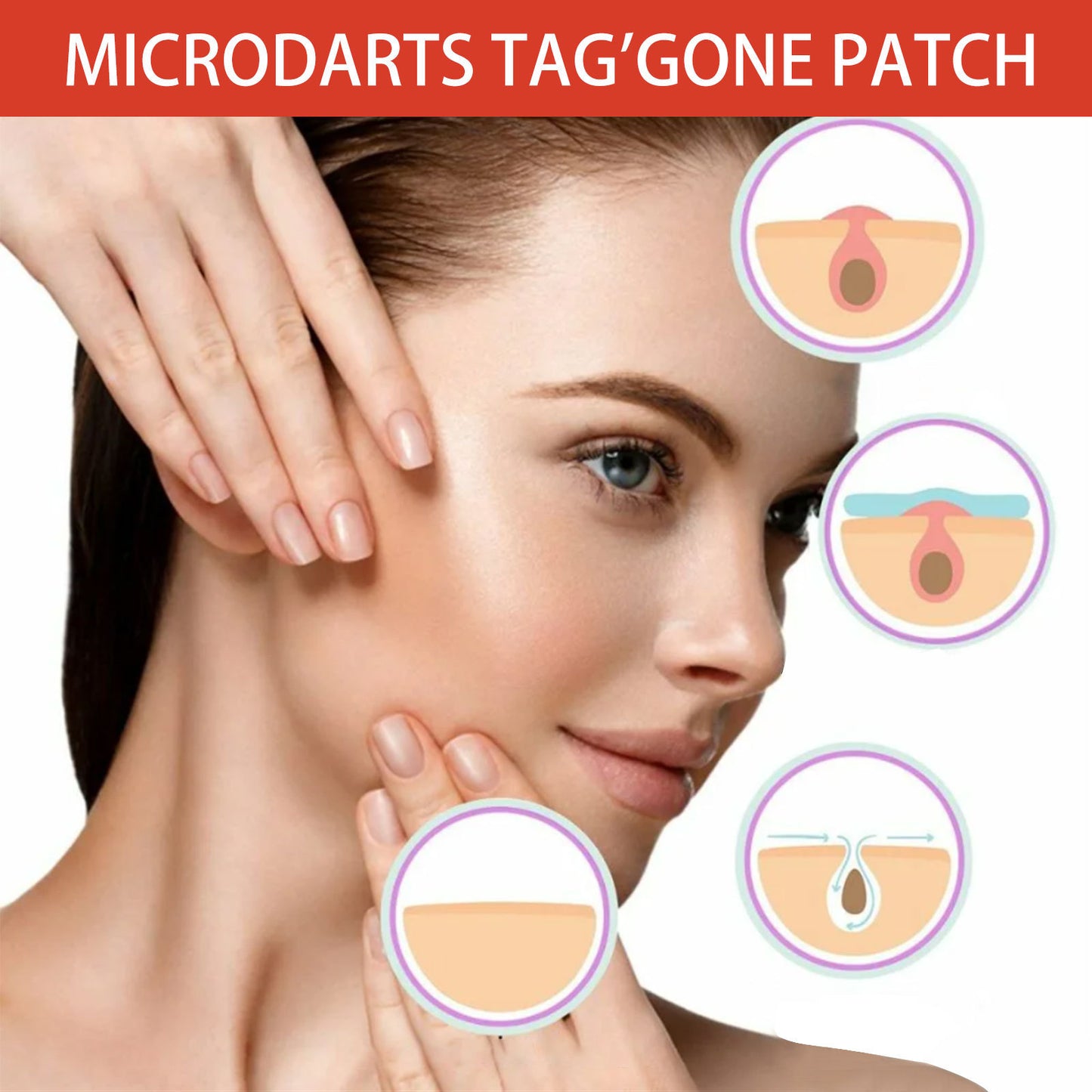 Skin Anti-acne Acne Black Mole Repair Skin Label