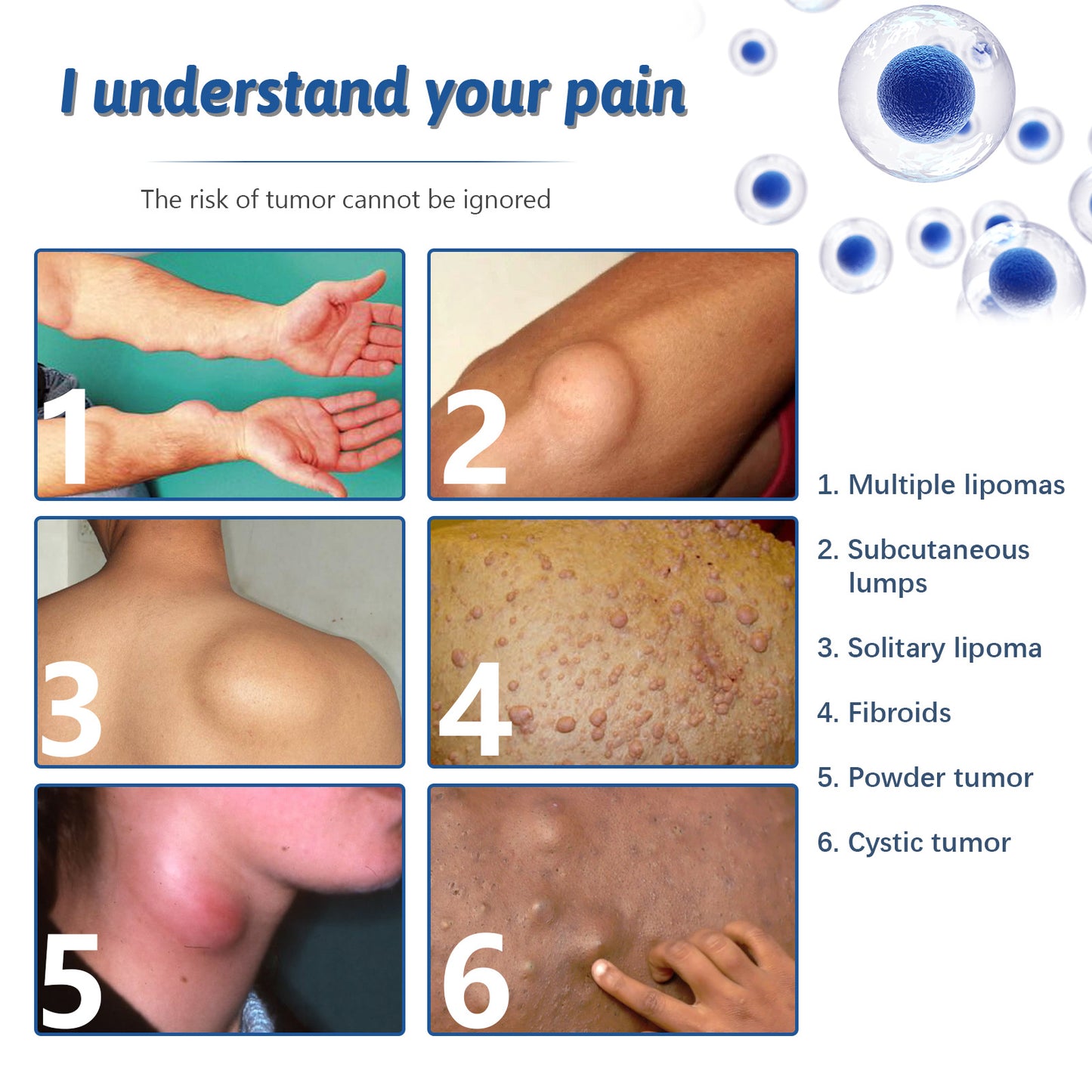Relief Of Body Fat Lump, Subcutaneous Fat Nodule, Dredging Spray