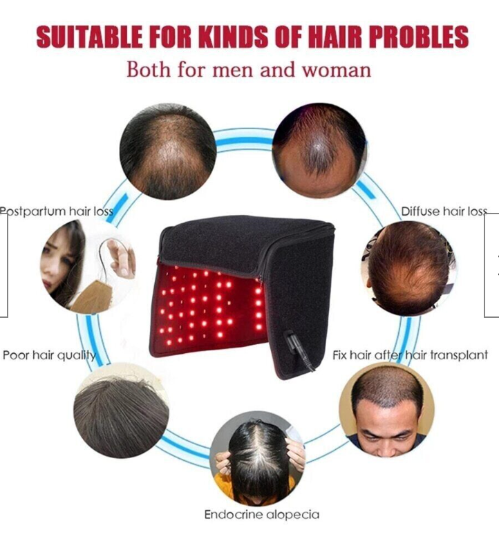 Red Light Hair Follicle Regrowth Stimulation Physiotherapy Canvas Helmet