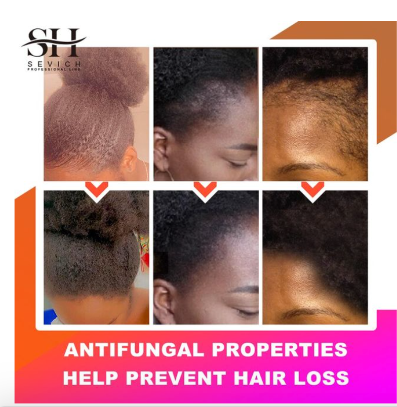 African Fast Growth Traction Alopecia Chebe Hair Mask