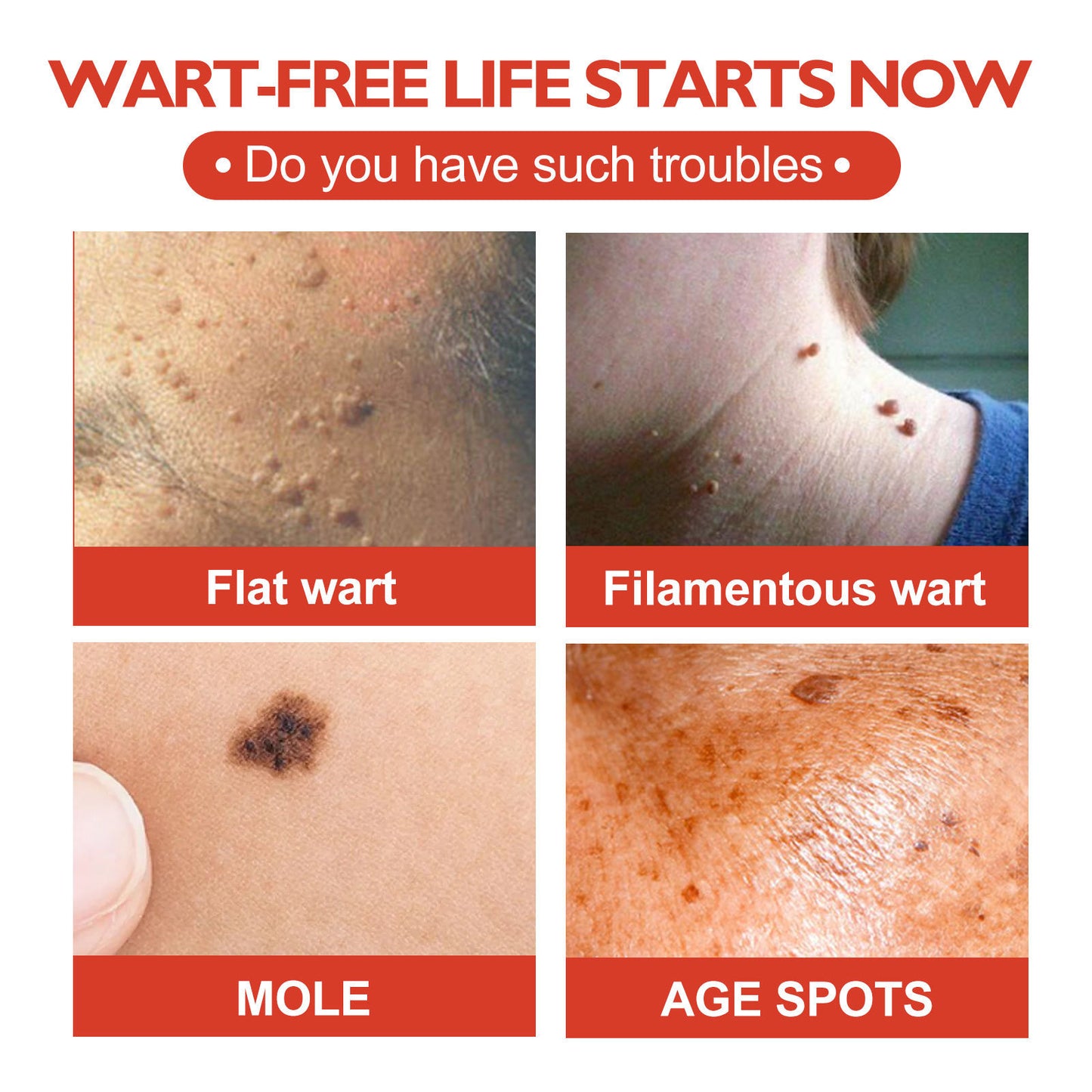 Skin Anti-acne Acne Black Mole Repair Skin Label
