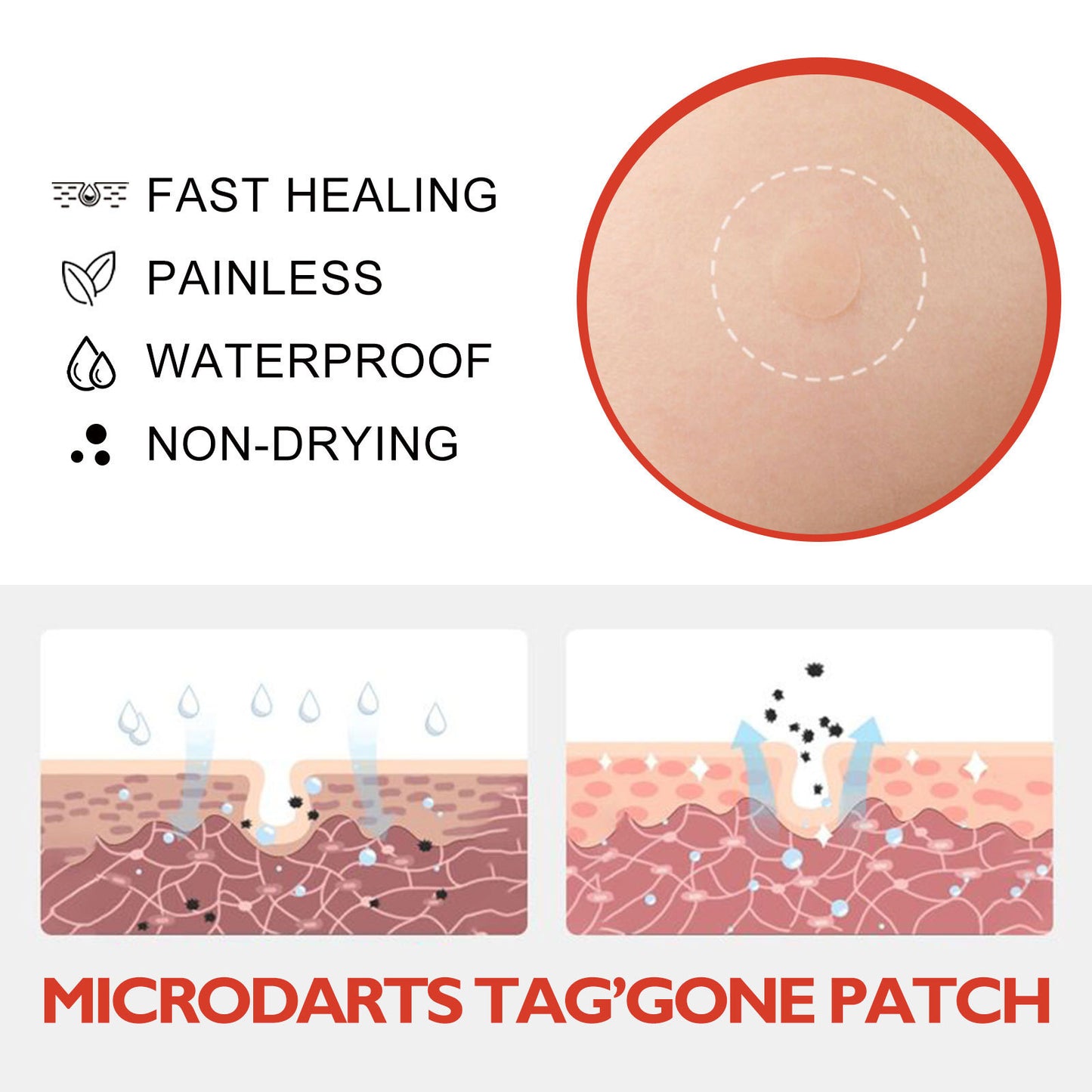 Skin Anti-acne Acne Black Mole Repair Skin Label