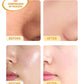 Blackhead Removing Turmeric Clay Mask Cleansing Pores Exfoliating