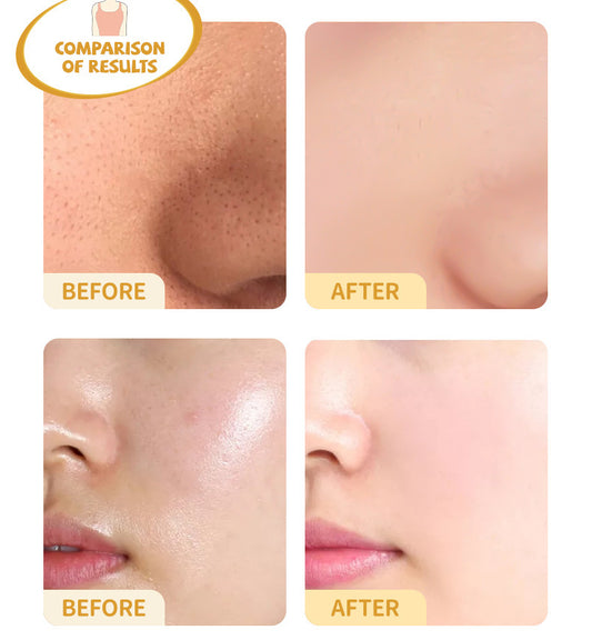 Blackhead Removing Turmeric Clay Mask Cleansing Pores Exfoliating