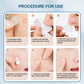 Hugrose Acne Patch