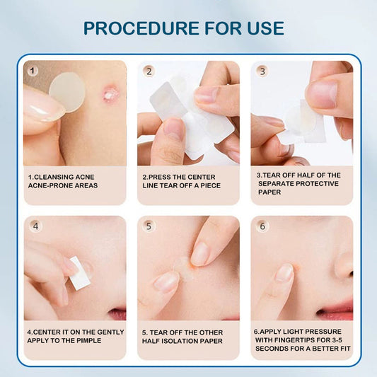 Hugrose Acne Patch