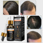 Ginger Hair Essential Oil Improves Circulation Scalp Massage Essential Oil