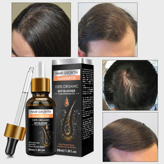 Ginger Hair Essential Oil Improves Circulation Scalp Massage Essential Oil